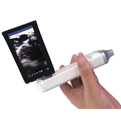 Wireless Medical Scan Linear Probe 