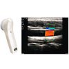 4D wireless Probe Ultrasound Handheld Scanner 